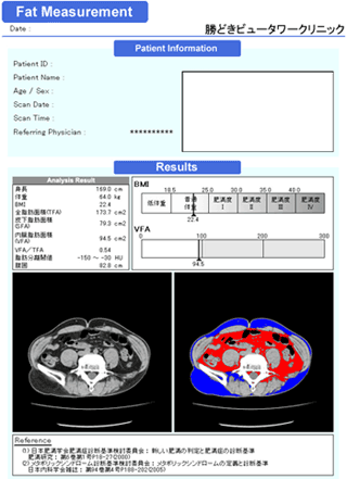 画像：内臓脂肪面積のCT測定・血管年齢検査について